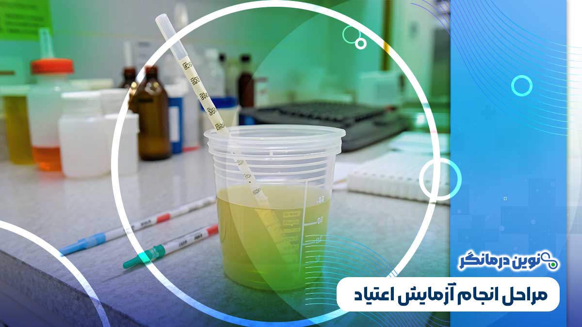 مراحل انجام آزمایش اعتیاد