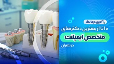 10 تا از بهترین دکترهای متخصص ایمپلنت در تهران