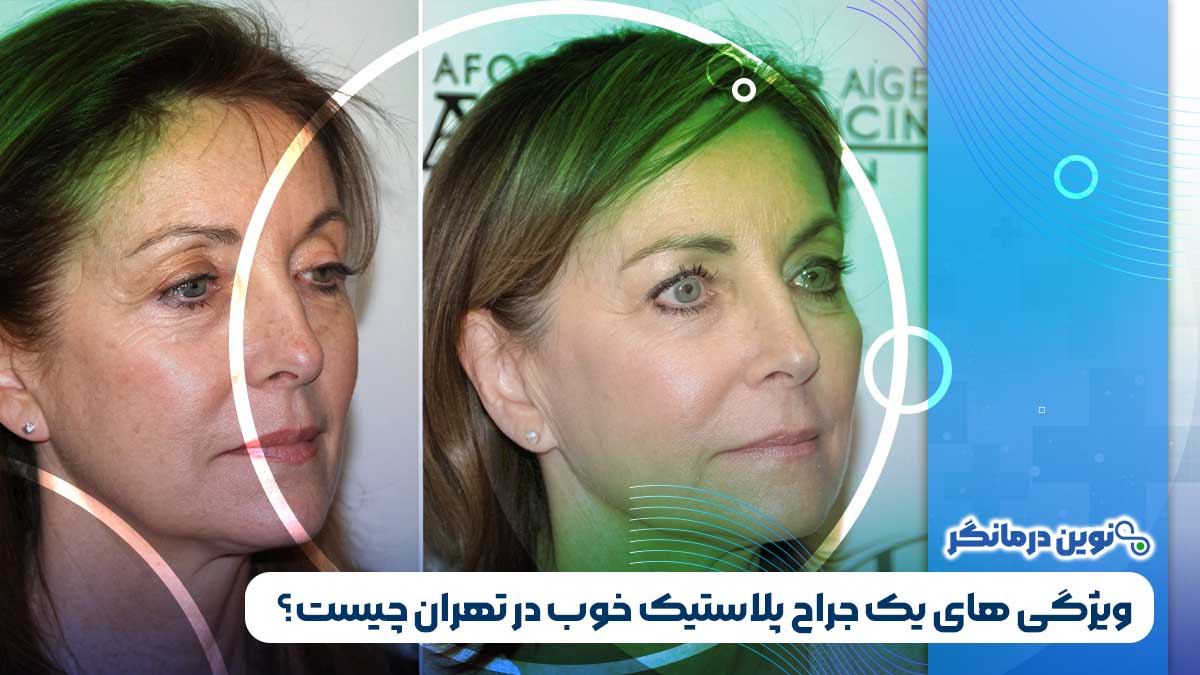 ویژگی های یک جراح پلاستیک خوب در تهران چیست؟