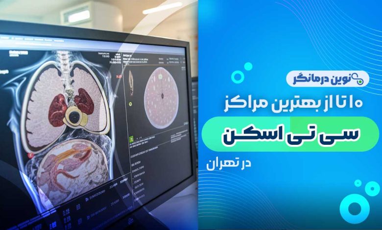 10 تا از بهترین مراکز سی تی اسکن در تهران