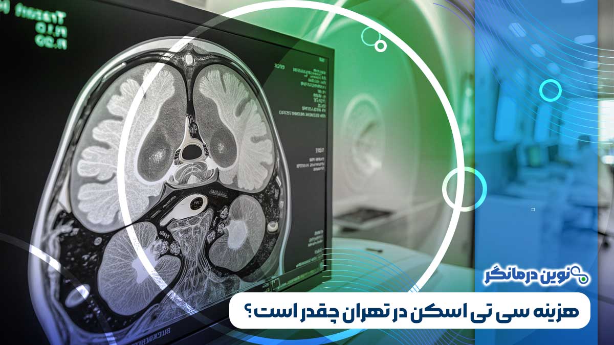هزینه سی تی اسکن در تهران چقدر است؟