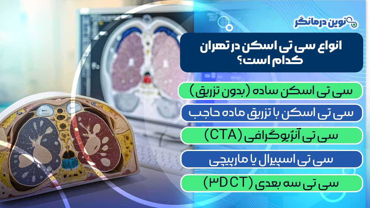 انواع سی تی اسکن در تهران کدام است؟