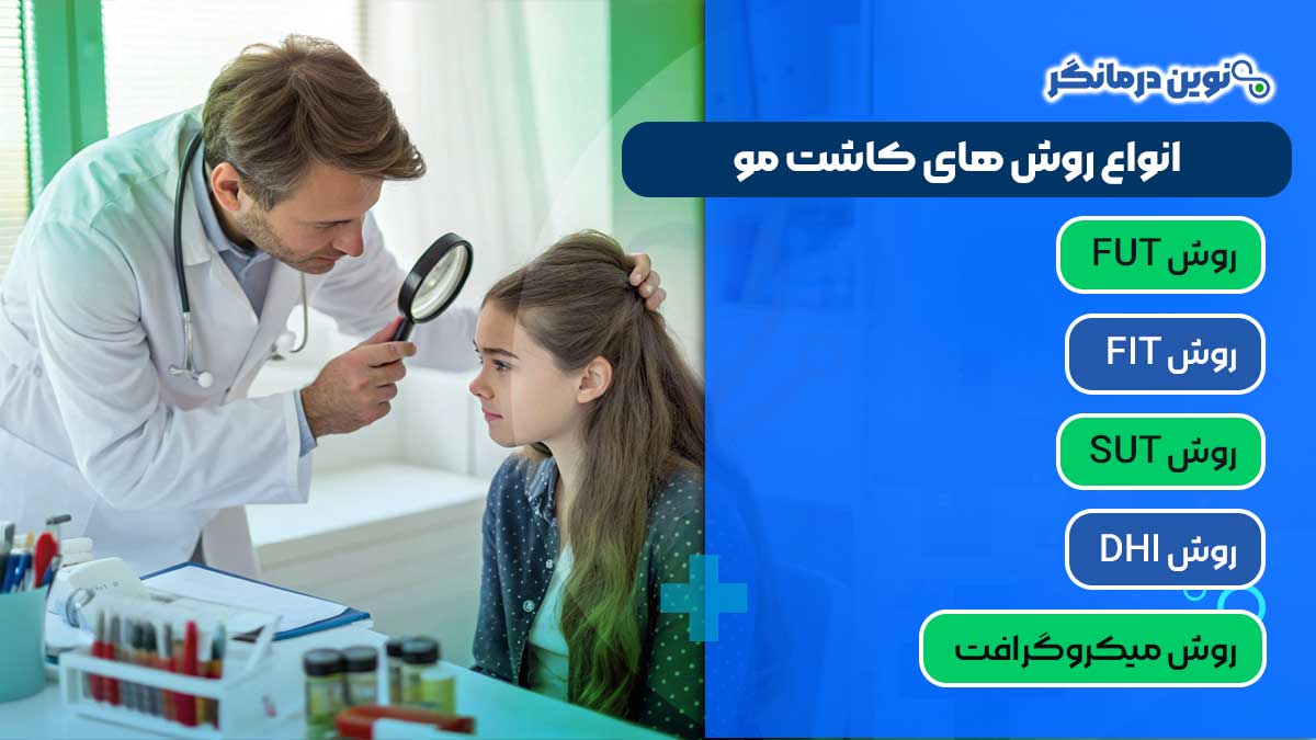 انواع روش های کاشت مو