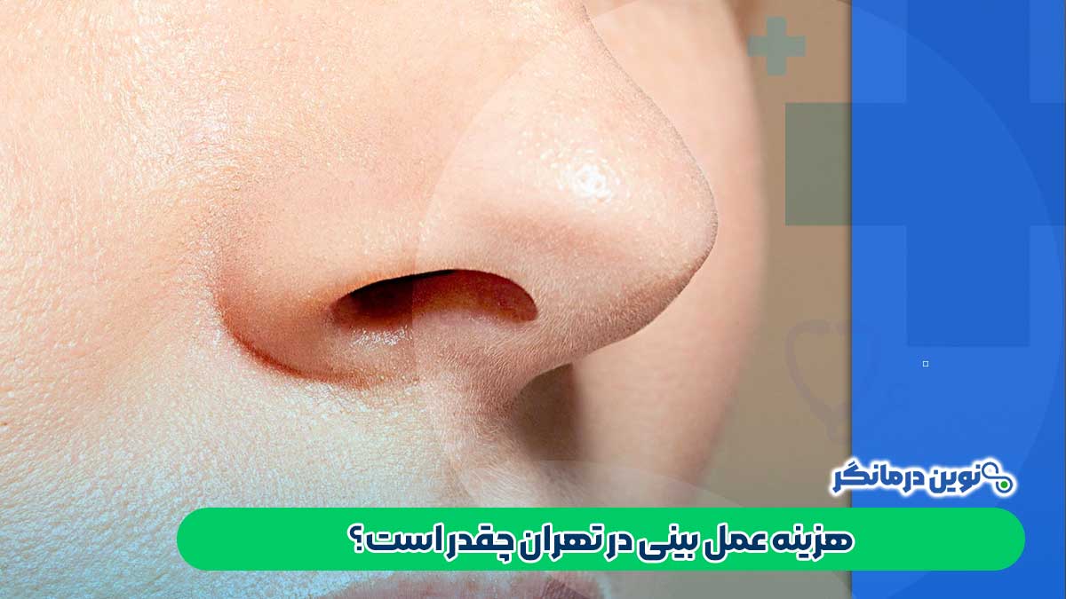 هزینه عمل بینی در تهران چقدر است؟