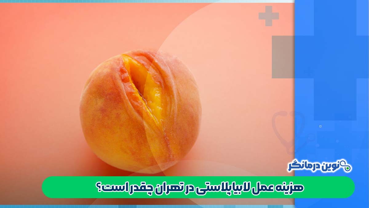 هزینه عمل لابیاپلاستی در تهران چقدر است؟