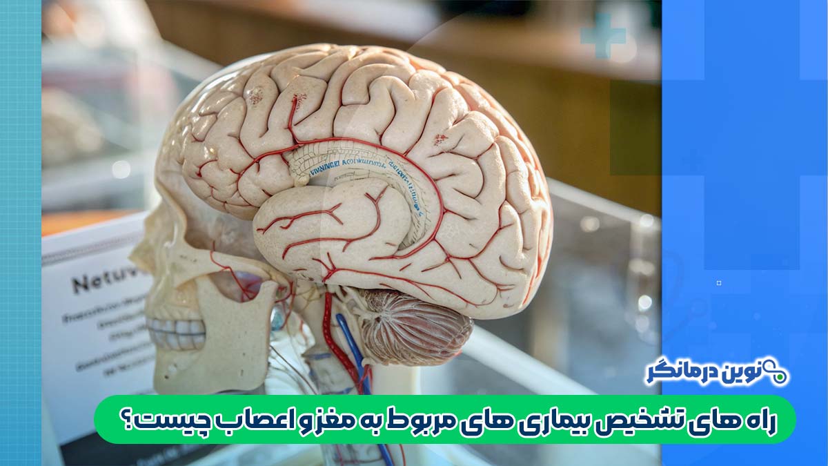 راه های تشخیص بیماری های مربوط به مغز و اعصاب چیست؟