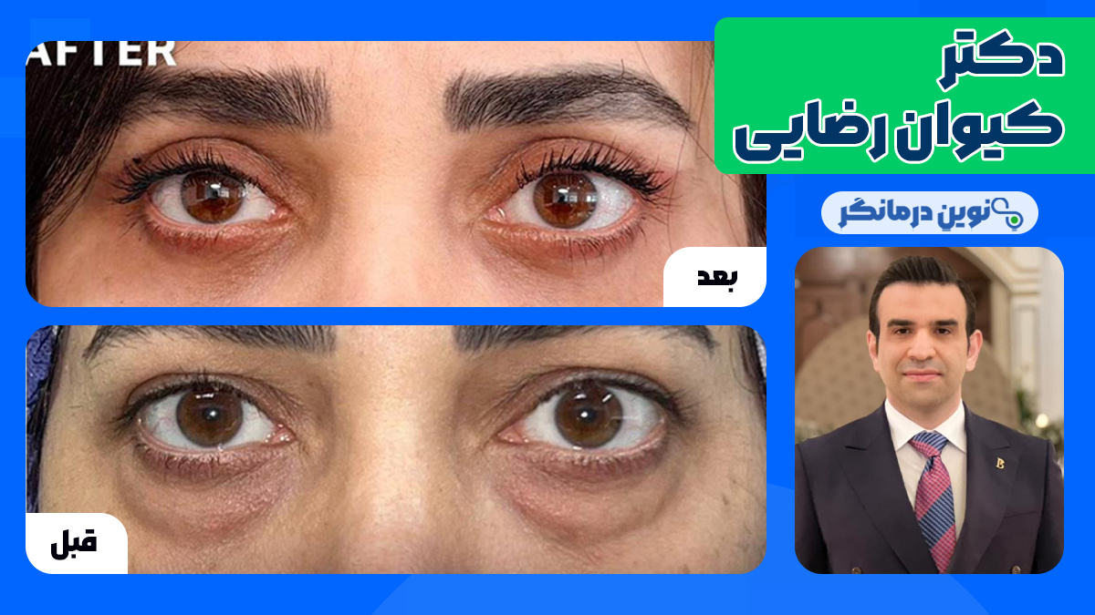 دکتر کیوان رضایی