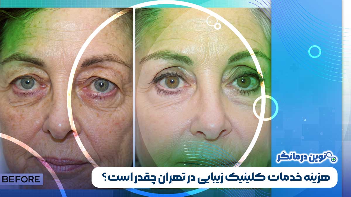 هزینه خدمات کلینیک زیبایی در تهران چقدر است؟