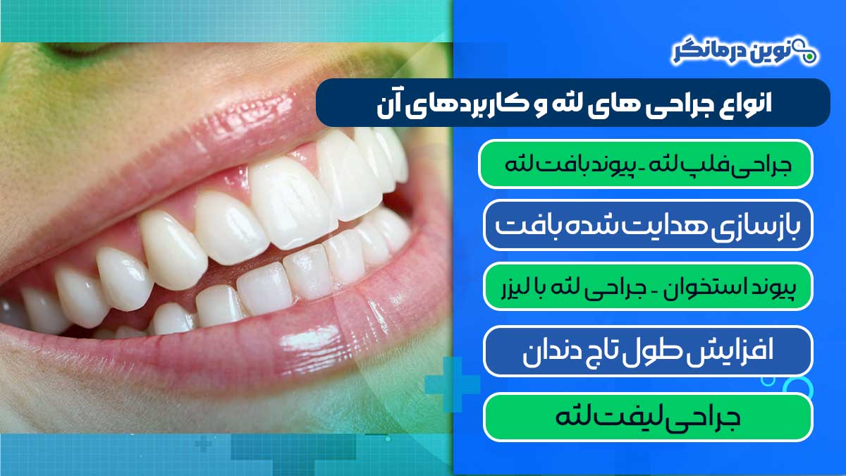 انواع جراحی‌ های لثه و کاربردهای آن‌