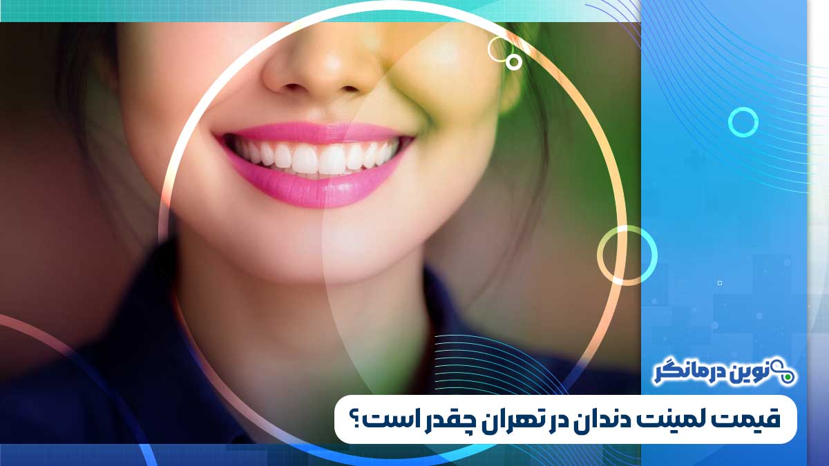 قیمت لمینت دندان در تهران چقدر است؟