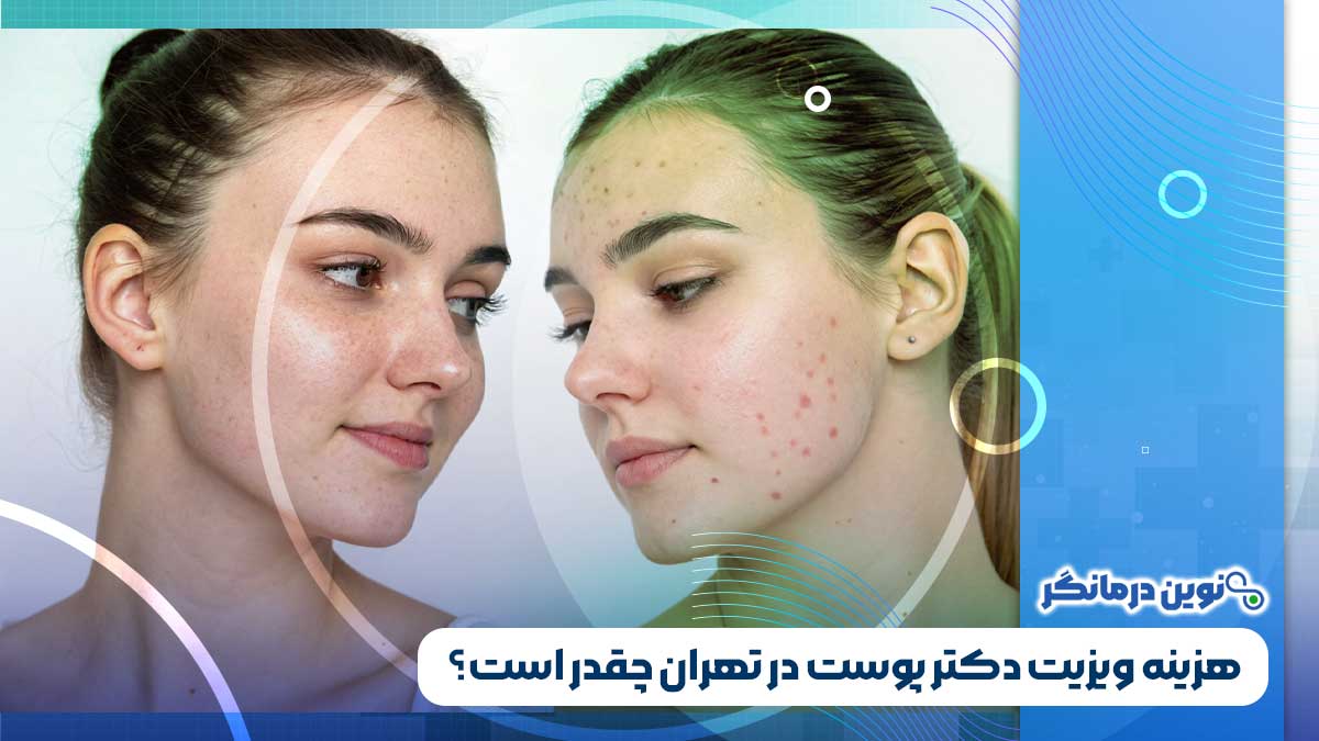 هزینه ویزیت دکتر پوست در تهران چقدر است؟