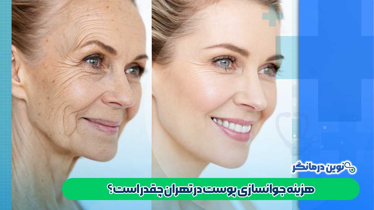 هزینه جوانسازی پوست در تهران چقدر است؟