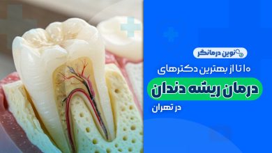 دکتر متخصص درمان ریشه دندان در تهران