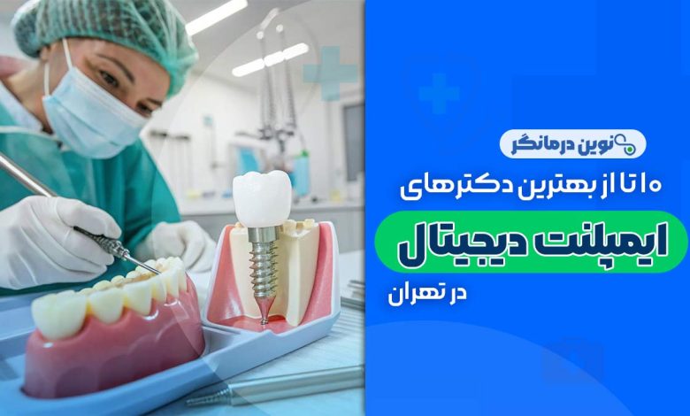 10 تا از بهترین دکترهای ایمپلنت دیجیتالی در تهران