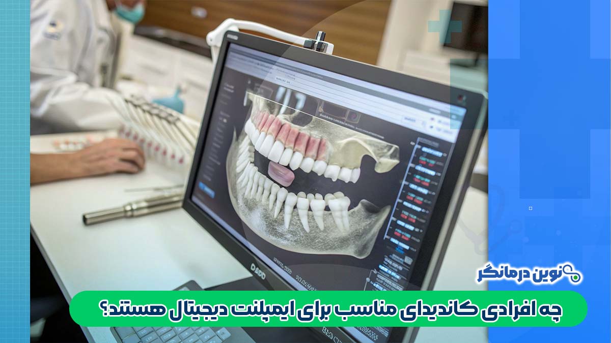 چه افرادی کاندیدای مناسب برای ایمپلنت دیجیتال هستند؟