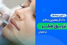 10 تا از بهترین دکترهای تزریق فیلر در تهران