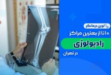 10 تا از بهترین مراکز رادیولوژی در تهران