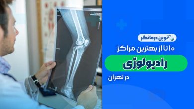 10 تا از بهترین مراکز رادیولوژی در تهران