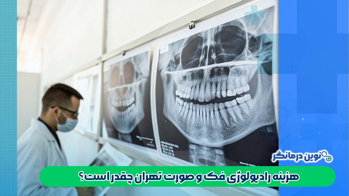 هزینه رادیولوژی فک و صورت تهران چقدر است؟