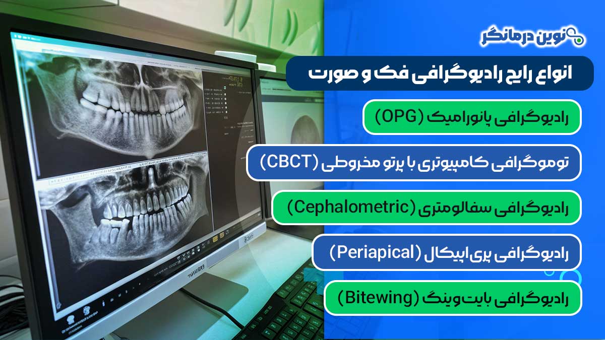 انواع رایج رادیوگرافی فک و صورت کدامند؟