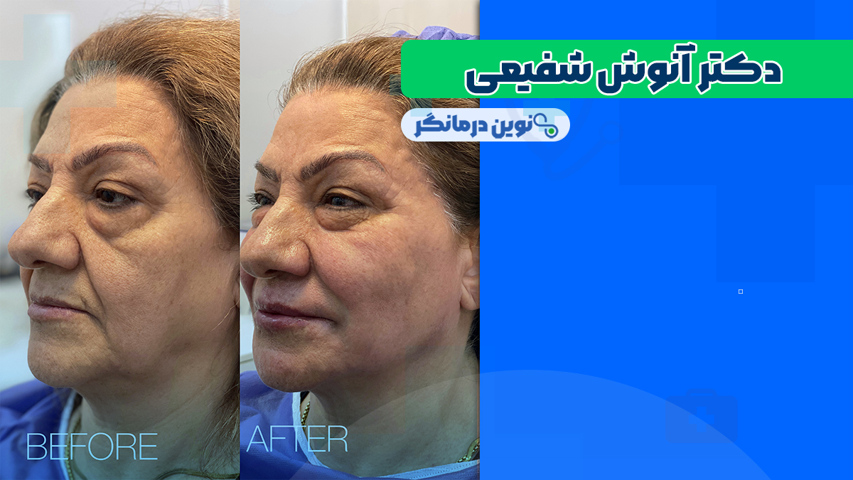 دکتر آنوش شفیعی