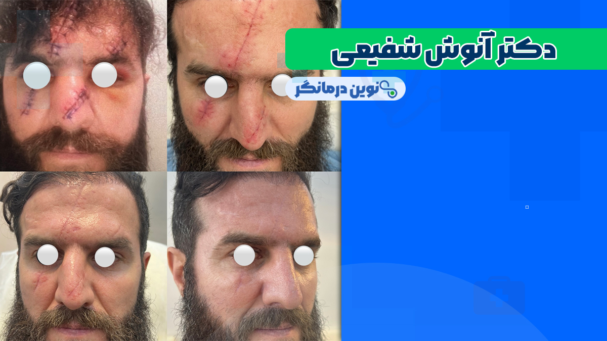 دکتر آنوش شفیعی