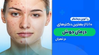 10 تا از بهترین دکترهای درمان جوش در تهران