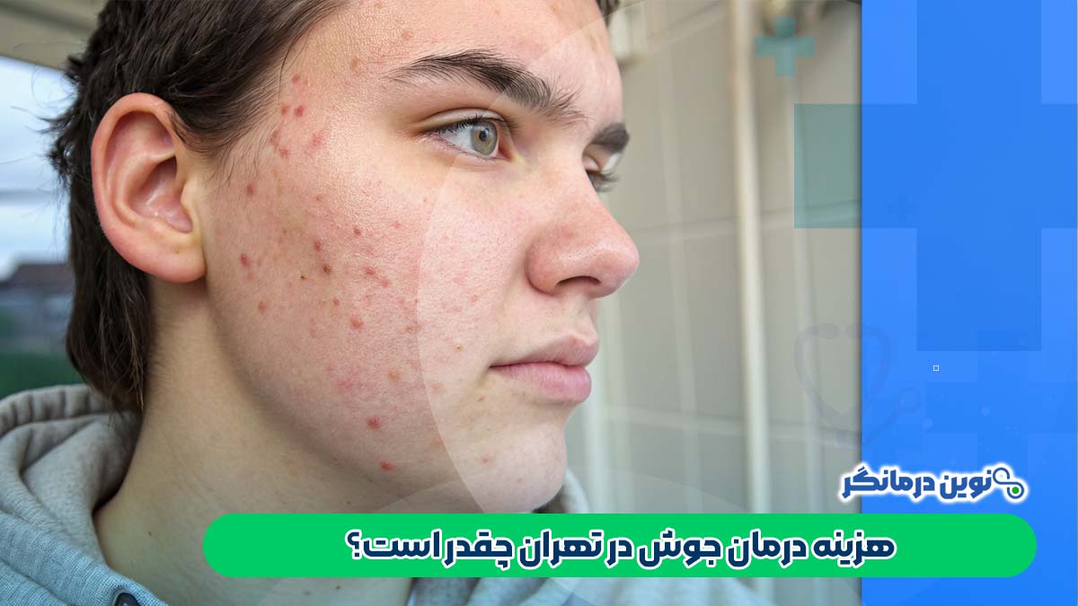 هزینه درمان جوش در تهران چقدر است؟