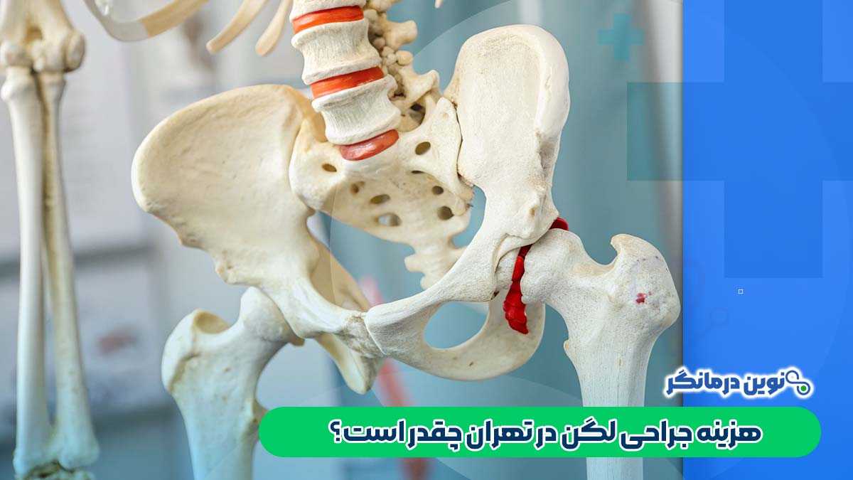 هزینه جراحی لگن در تهران چقدر است؟