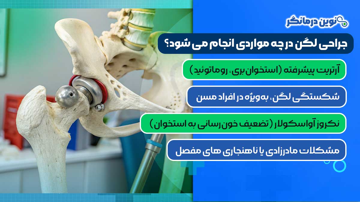 جراحی لگن در چه مواردی انجام می شود؟