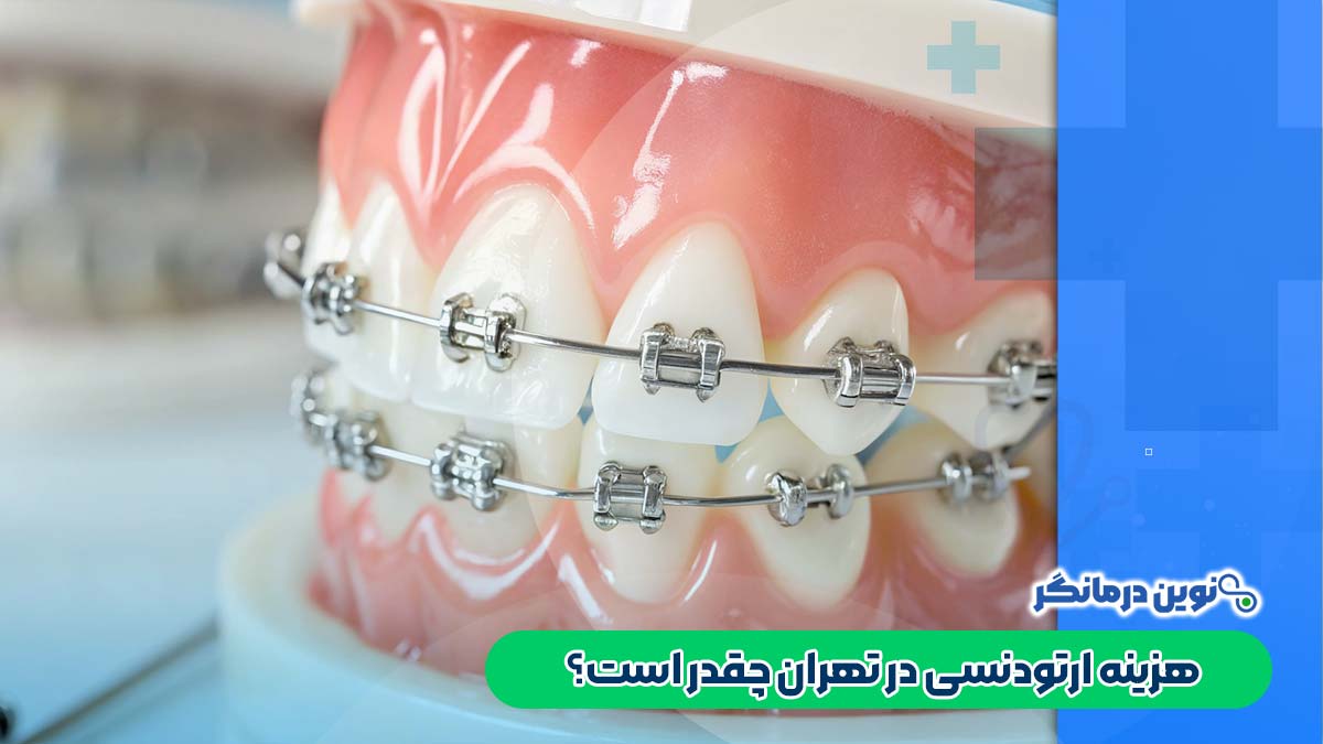 هزینه ارتودنسی در تهران چقدر است؟