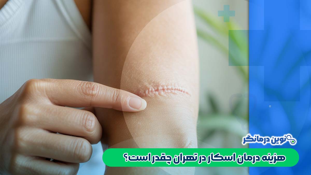 هزینه درمان اسکار در تهران چقدر است؟