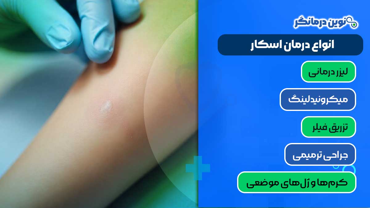 انواع درمان اسکار