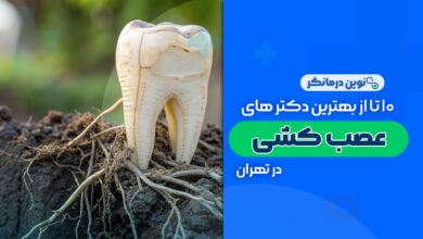 10 تا از بهترین دکترهای متخصص عصب کشی در تهران