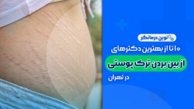 10 تا از بهترین دکترهای از بین بردن ترک های پوستی در تهران