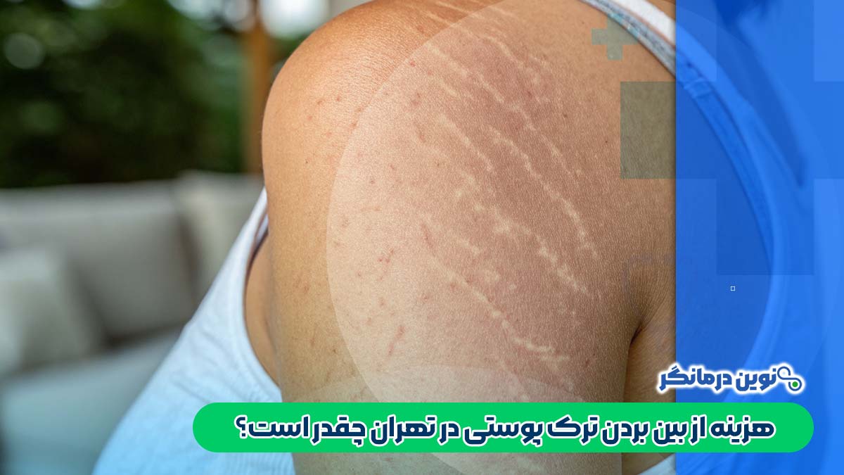 هزینه از بین بردن ترک پوستی در تهران چقدر است؟