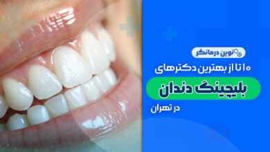 10 تا از بهترین دکترهای بلیچینگ دندان در تهران