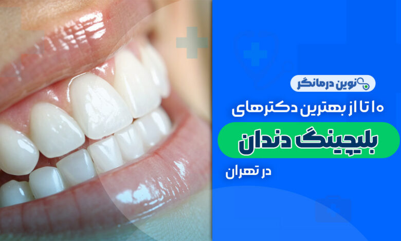 10 تا از بهترین دکترهای بلیچینگ دندان در تهران