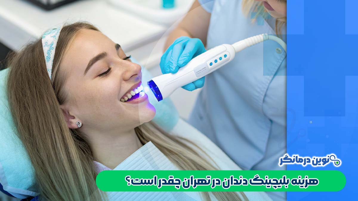 هزینه بلیچینگ دندان در تهران چقدر است؟