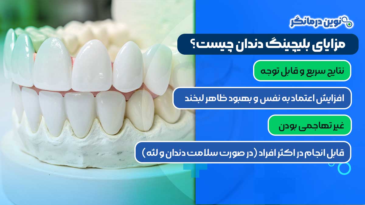 مزایای بلیچینگ دندان چیست؟