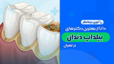 10 تا از بهترین دکترهای بیلداپ دندان در تهران