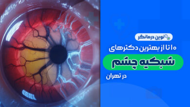 10 تا از بهترین دکترهای فوق تخصص شبکیه چشم در تهران