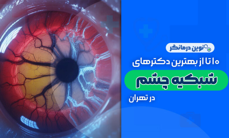 10 تا از بهترین دکترهای فوق تخصص شبکیه چشم در تهران