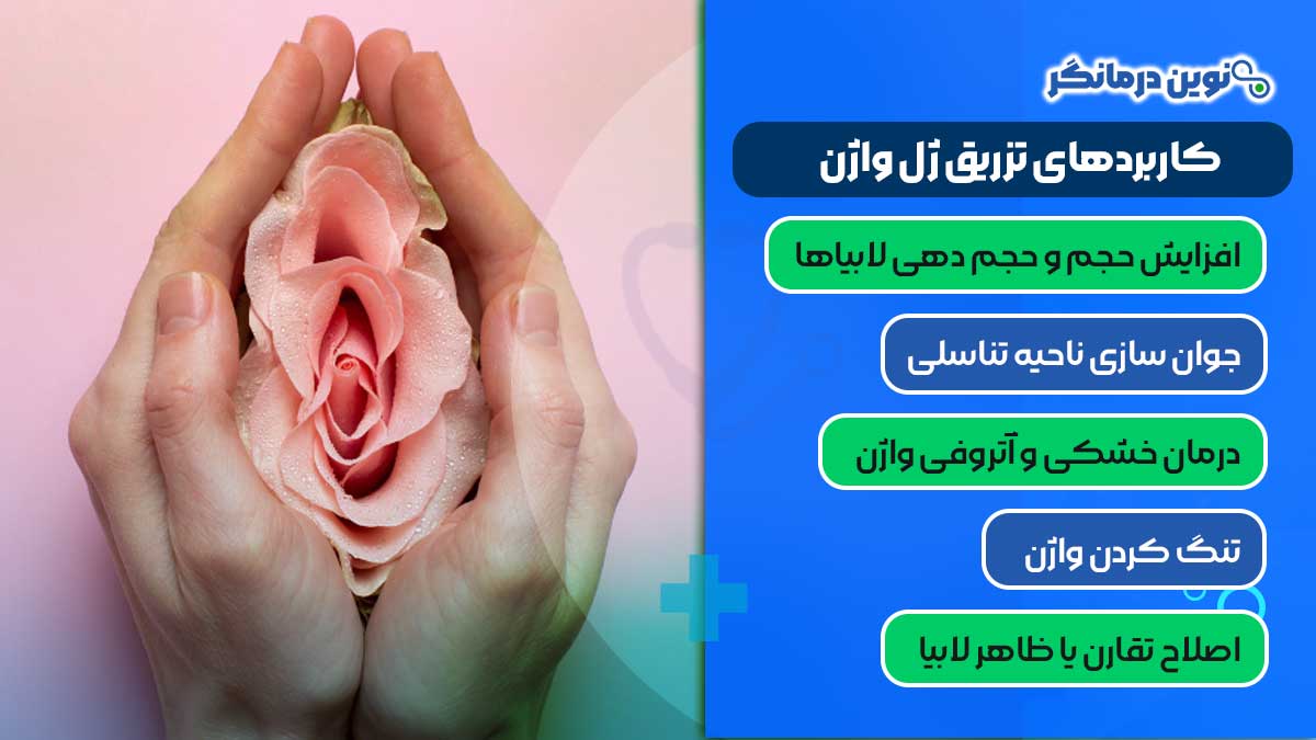 کاربردهای تزریق ژل واژن