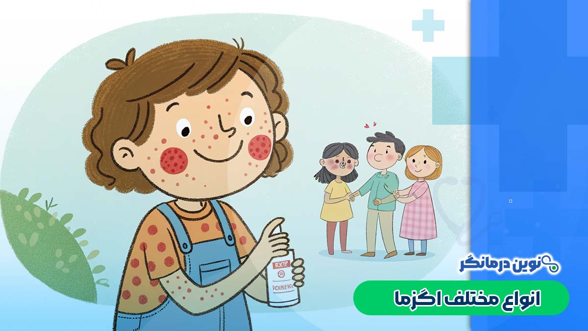 انواع مختلف اگزما