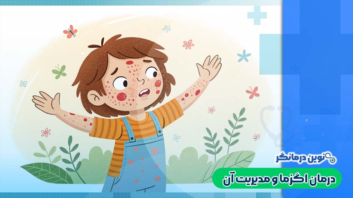 درمان اگزما و مدیریت آن