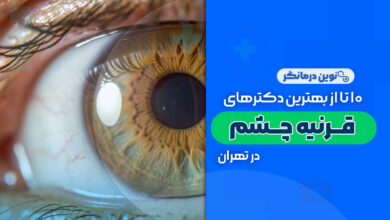 10 تا از بهترین دکترهای فوق تخصص قرنیه چشم در تهران
