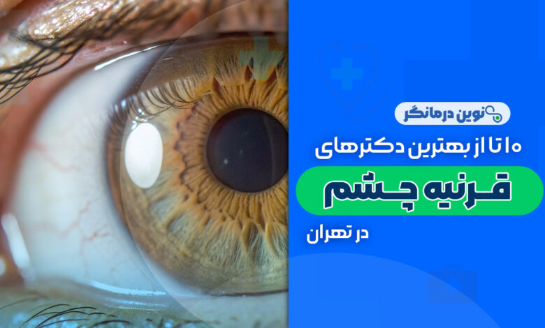 10 تا از بهترین دکترهای فوق تخصص قرنیه چشم در تهران