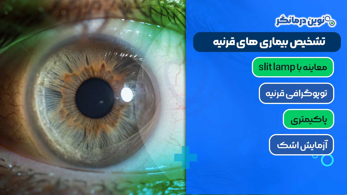 تشخیص بیماری‌ های قرنیه