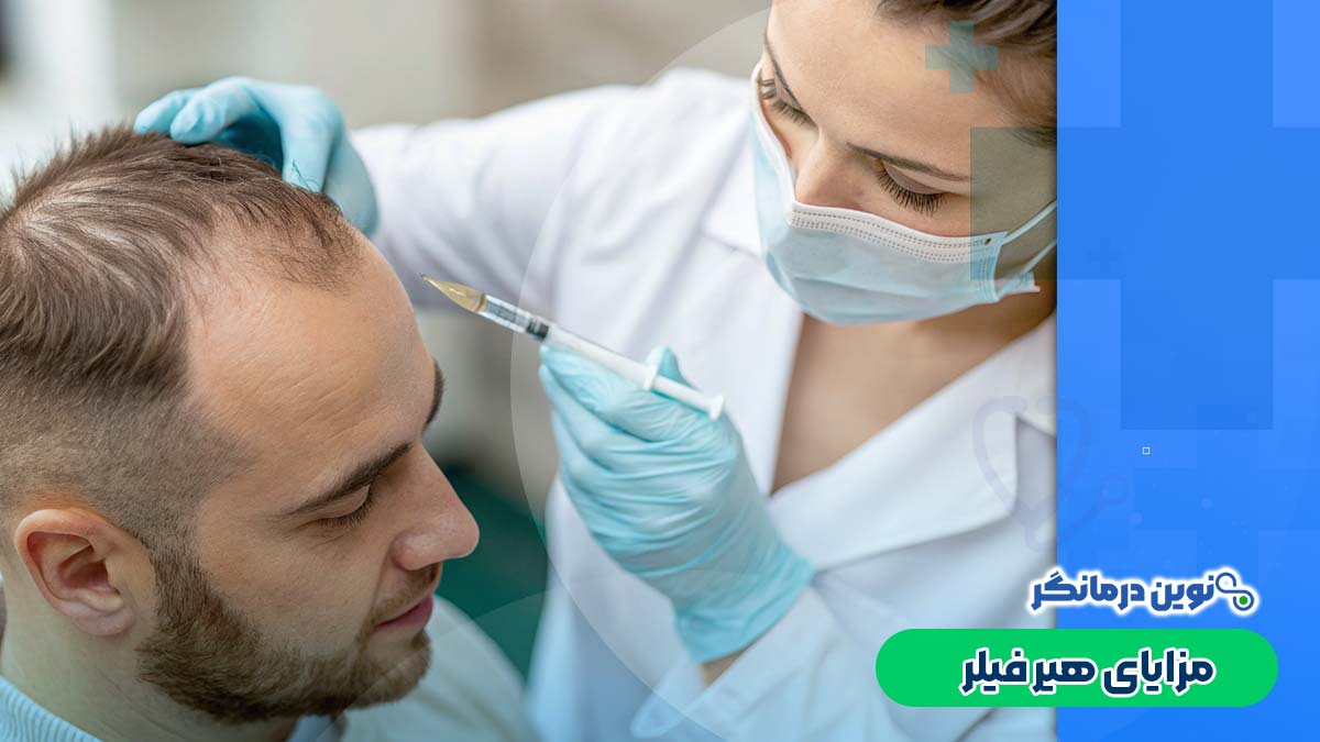 مزایای هیر فیلر